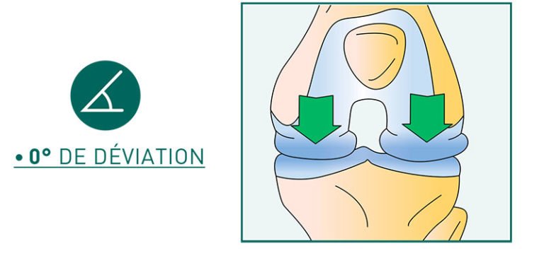 Traitement de l’arthrose à Paris – L’axe biomécanique du genou – Dr Mylle